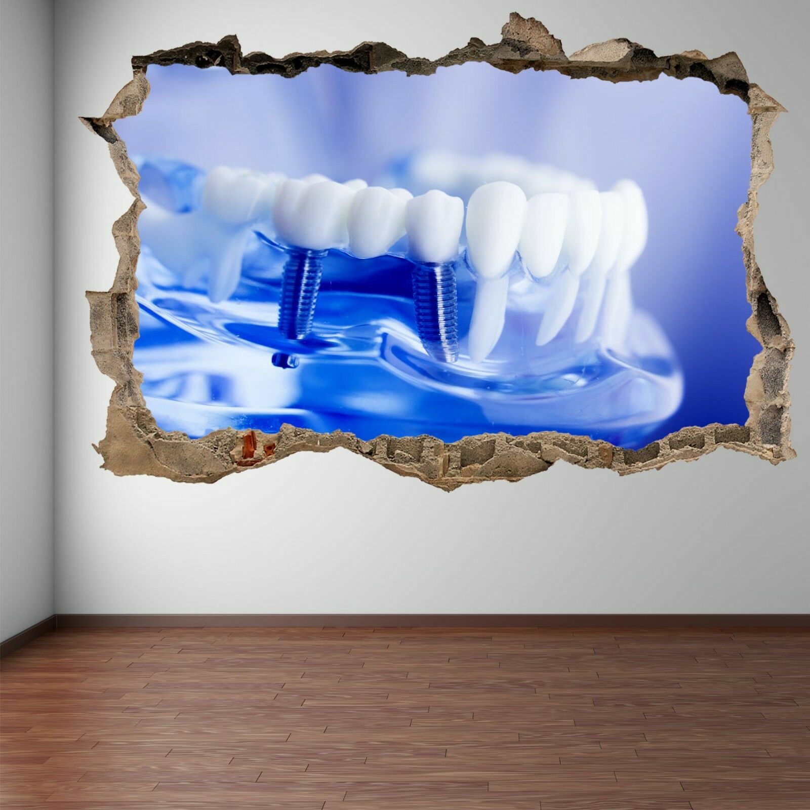 Implant Tooth Dental Care Wall Art Stickers Mural Decal Decor EC56