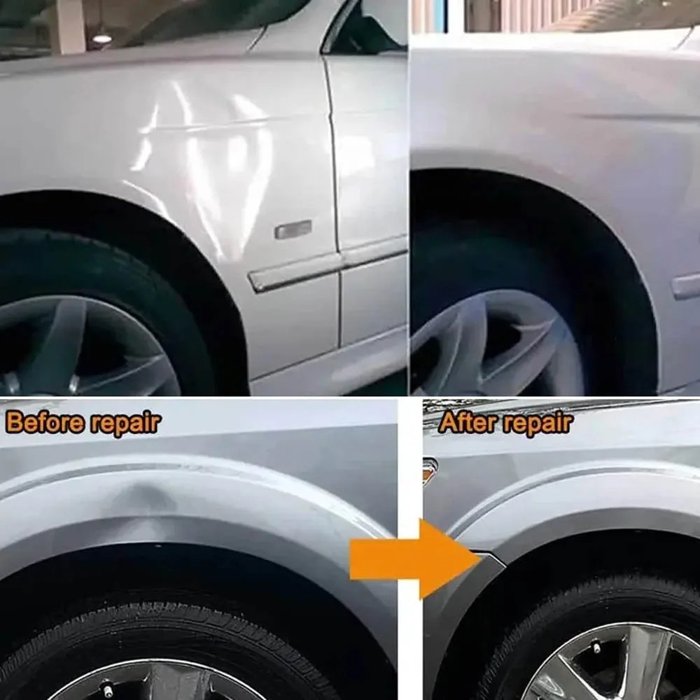 DIY Car Dent Repair Kit – Paintless Dent Remover for Auto, SUV & Truck Body