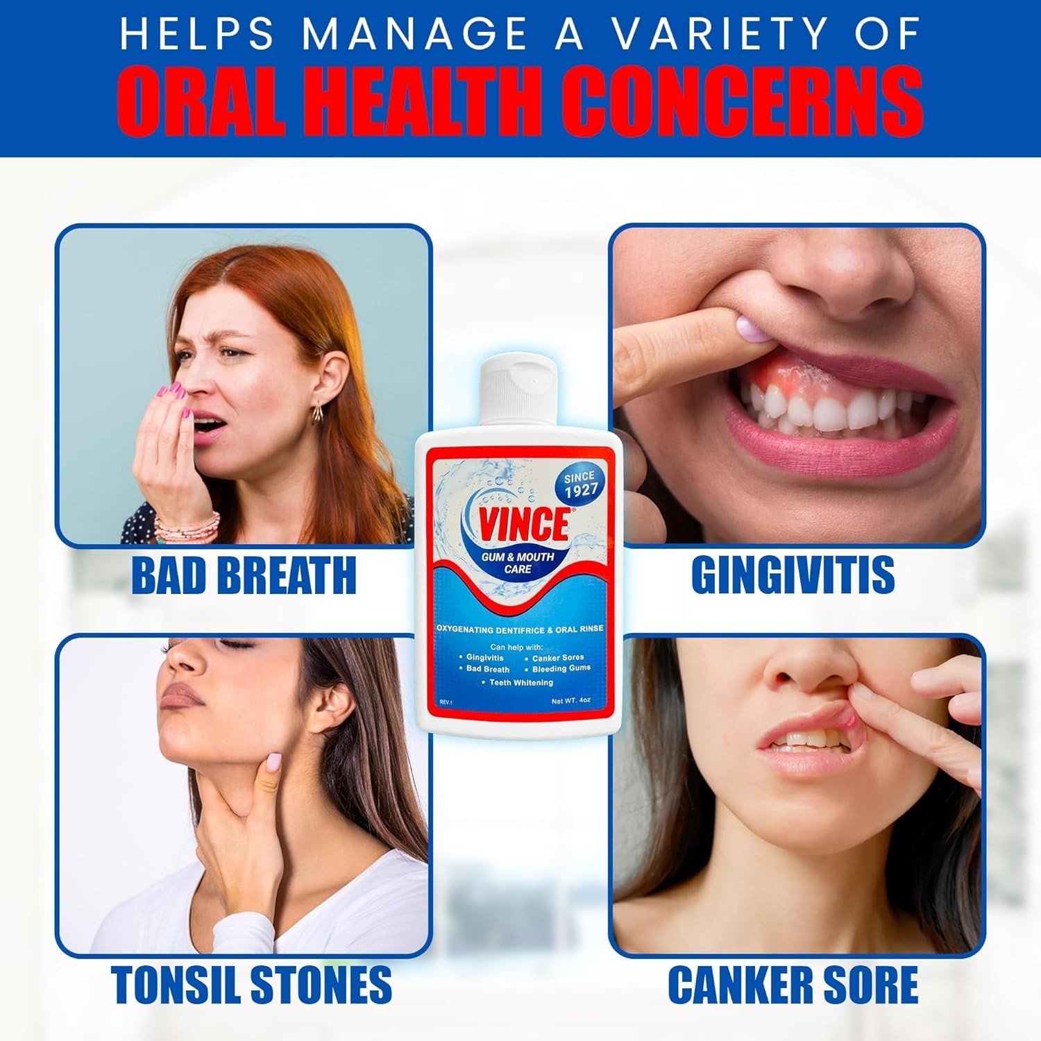 Gum & Mouth Toothpaste Powder – Dentifrice & 4 Ounce (Pack of 1)