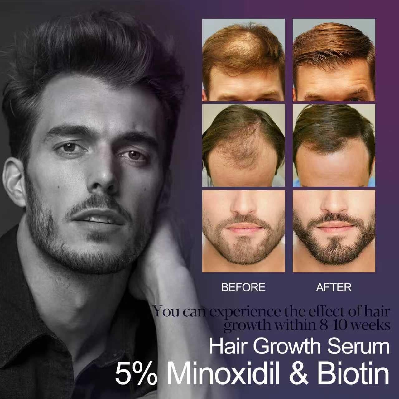 Hair Growth Treatment for Thicker Longer, 5% Minoxidil Biotin Hair Growth Serum